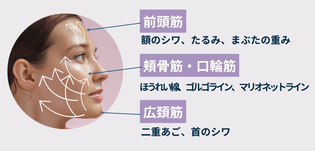 ３か所同時施術