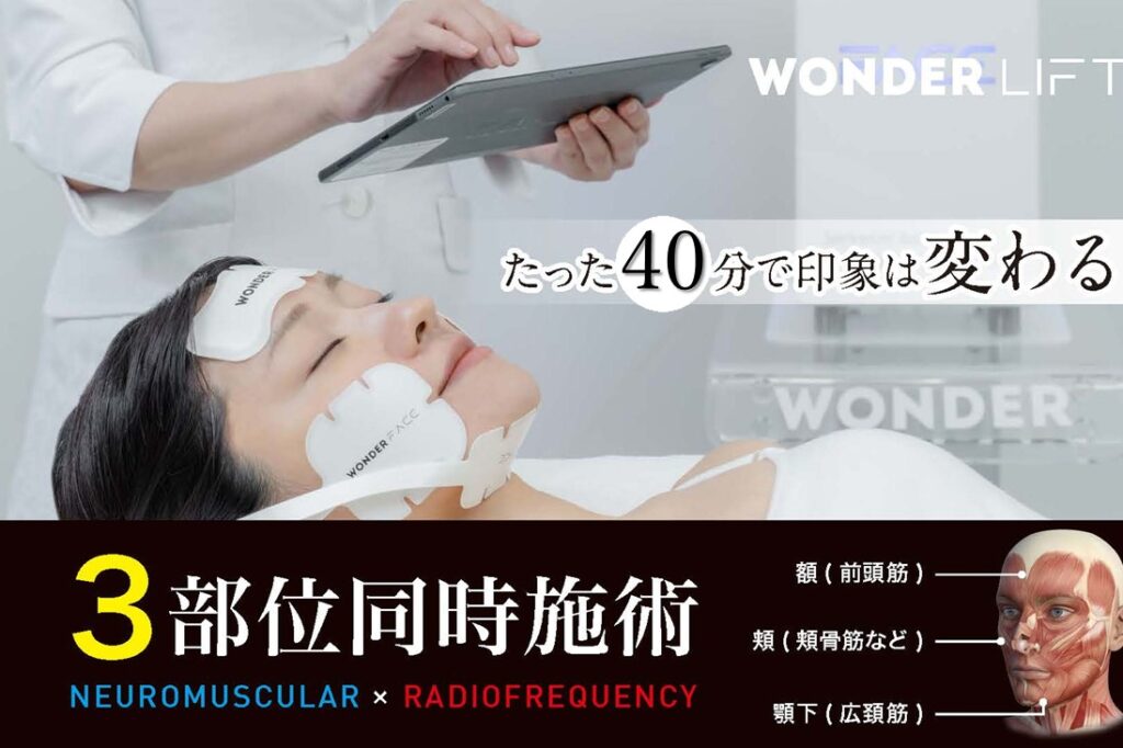 ワンダー初登場